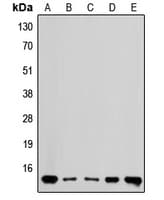 RPL36 / Ribosomal Protein L36 Antibody (Internal)