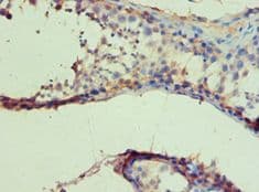 Polyclonal Rabbit anti-Human IDH1 / IDH Antibody (aa1-240, IHC, WB)
