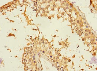 NTM / Neurotrimin Antibody