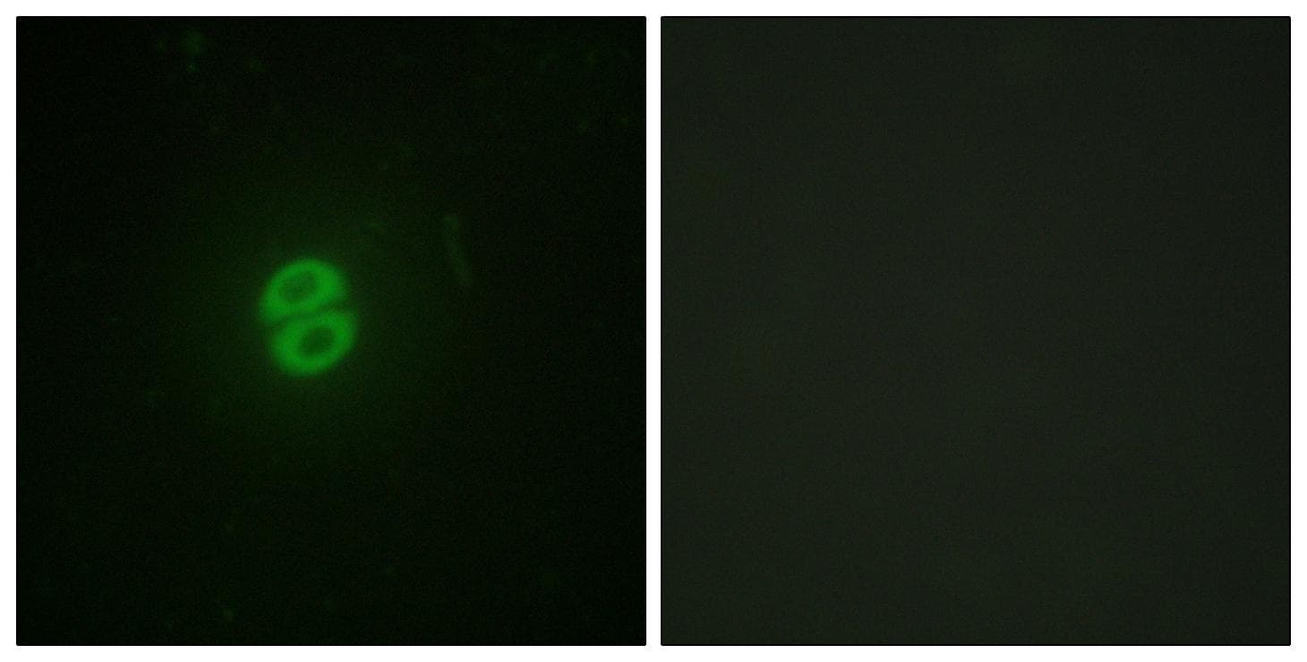 TNFSF10 / TRAIL Antibody