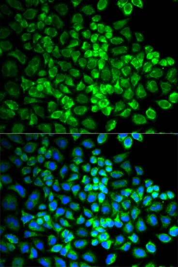 GRIA3 / GLUR3 Antibody
