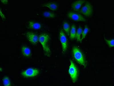 Polyclonal Rabbit anti-Human TRPM8 Antibody