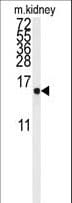 Polyclonal Rabbit anti-Human LSM1 Antibody (aa33-61, WB)