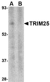 Polyclonal Rabbit anti-Human TRIM25 Antibody (IF, WB)
