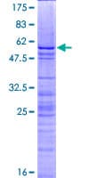 Human H1F0 Protein (Recombinant GST)