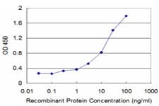 GIF / Intrinsic Factor Antibody (clone 1D9)