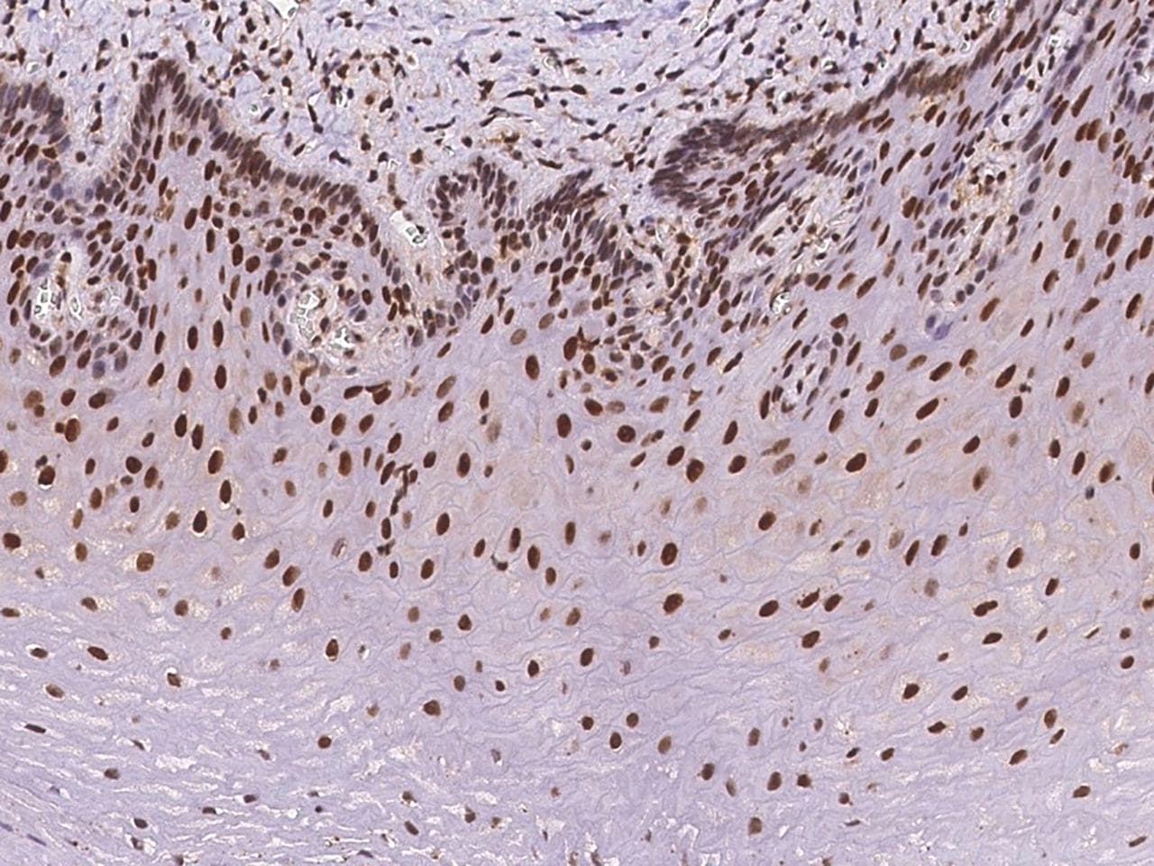 Polyclonal Rabbit anti-Human NACC1 / NAC1 Antibody (IHC)