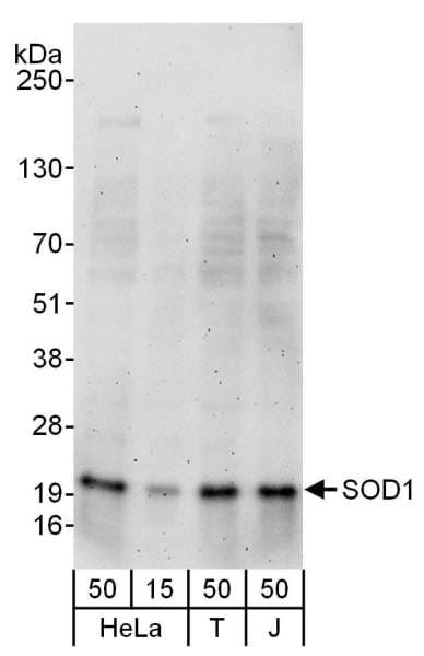 Polyclonal Rabbit anti-Human SOD1 / Cu-Zn SOD Antibody (aa54-104, IHC, WB)