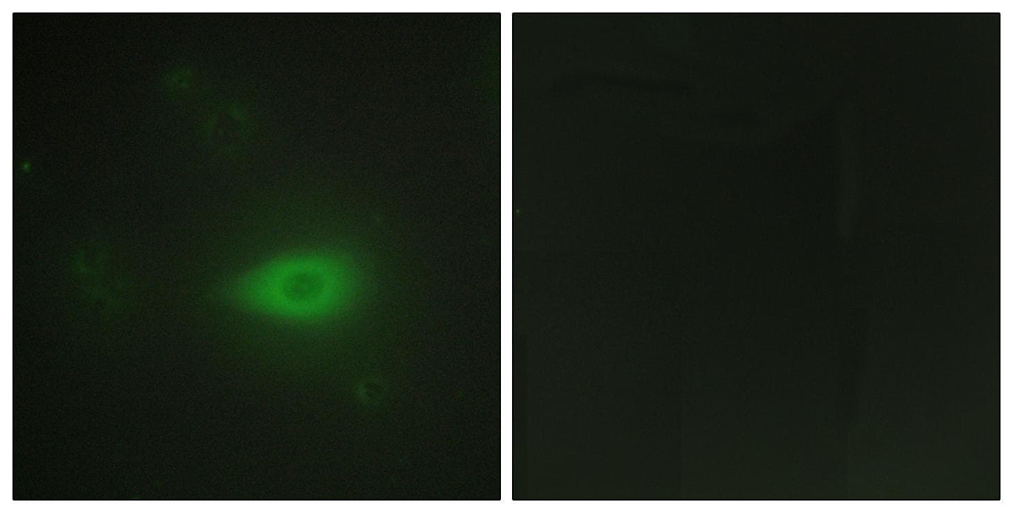 HARS Antibody