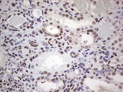 SAE1 Antibody (clone OTI3C3)