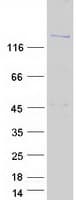 Human KIAA0476 / DENND4B Protein (Recombinant Myc-DDK (Flag))