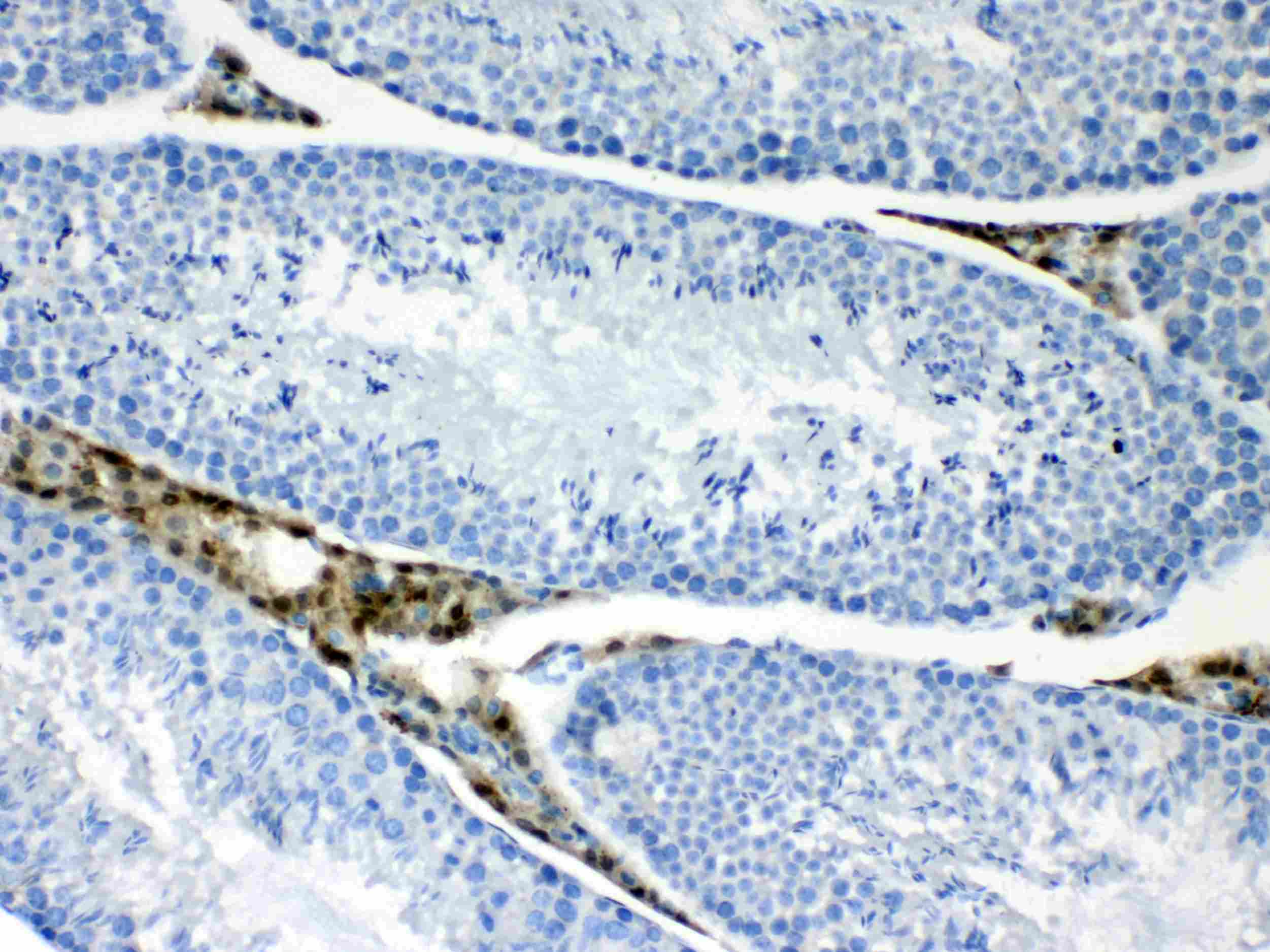 PPP1R14A / CPI-17 Antibody