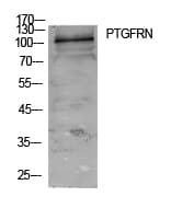 Polyclonal Rabbit anti-Human PTGFRN Antibody (aa601-650, WB)