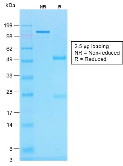 Histone H1 Antibody (clone r1415-1)