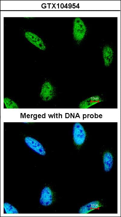 IPMK Antibody (aa26-295)