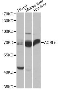 ACS5 / ACSL5 Antibody