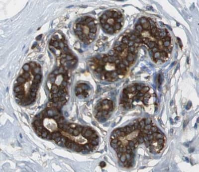 KRT13 / CK13 / Cytokeratin 13 Antibody