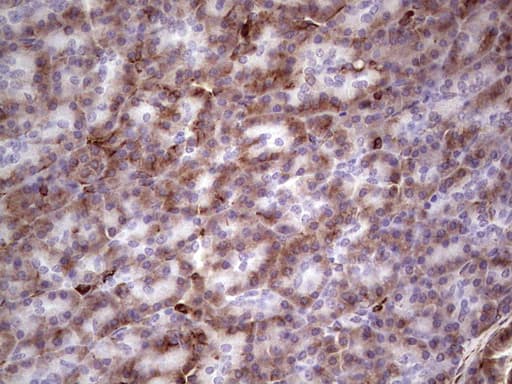 Peripherin Antibody (clone OTI1E10)