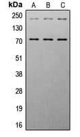 IGF1R / IGF1 Receptor Antibody (phospho-Tyr1161)