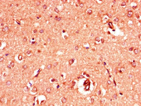 GRIA4 / GLUR4 Antibody