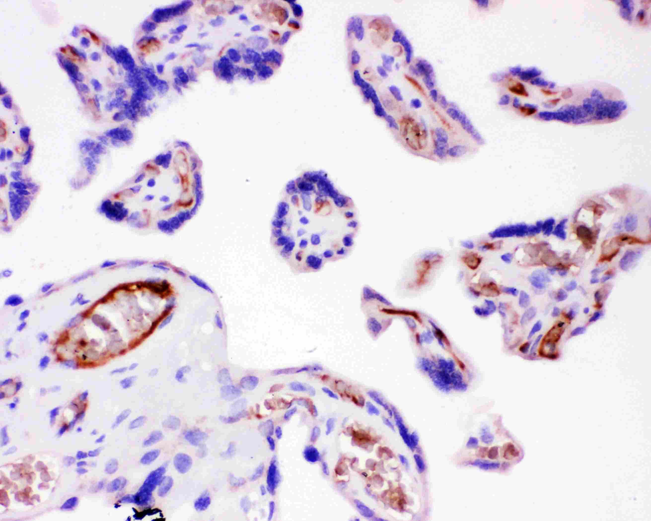 Polyclonal Rabbit anti-Human ITGB1 / Integrin Beta 1 / CD29 Antibody (aa527-728, IHC, WB)