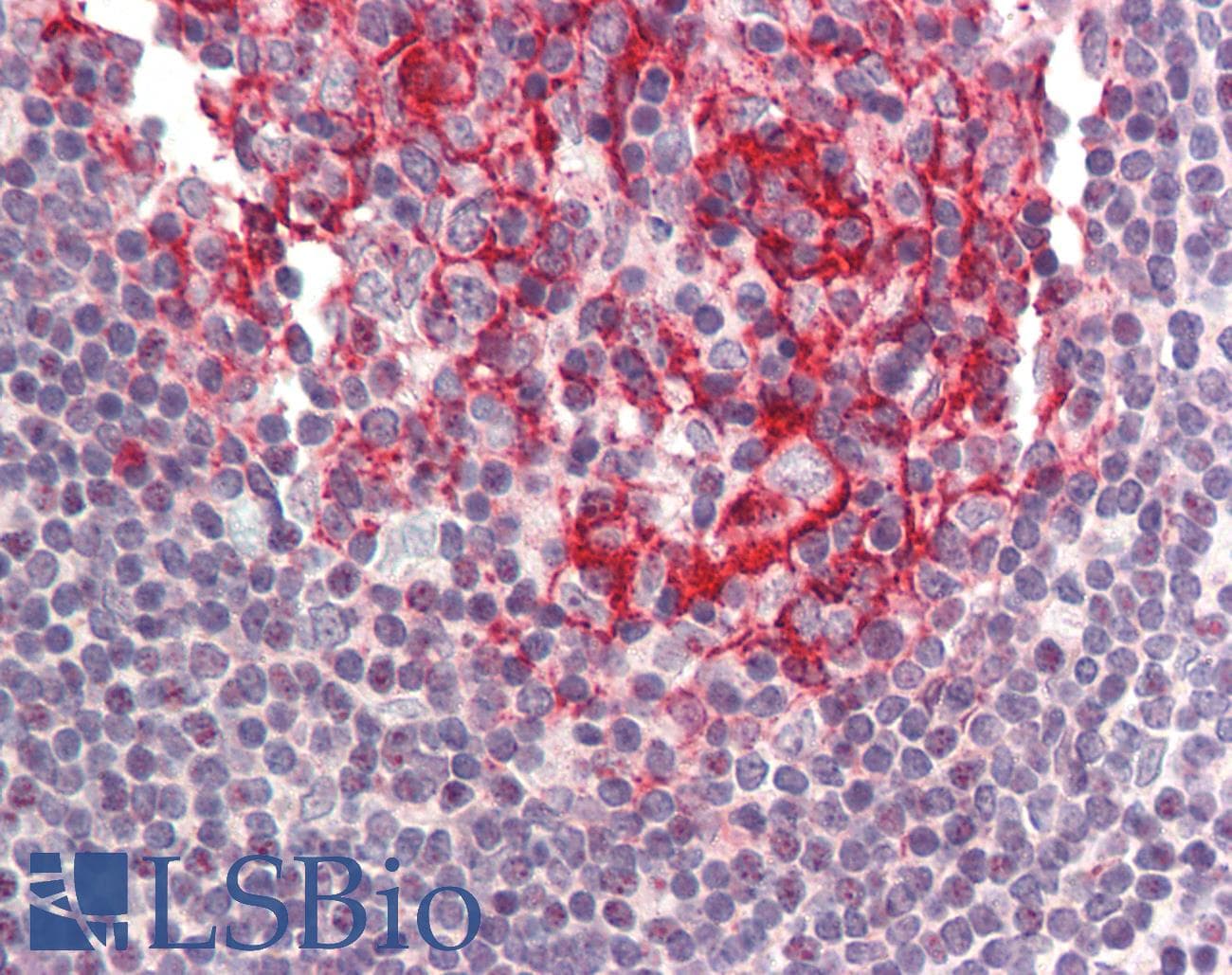 IHC-plus™ Polyclonal Rabbit anti-Human BIRC8 / ILP2 Antibody (IHC, IF, WB)