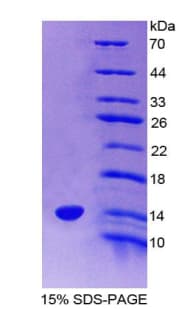 Rat VPREB1 / CD179A Protein (Recombinant His-T7)
