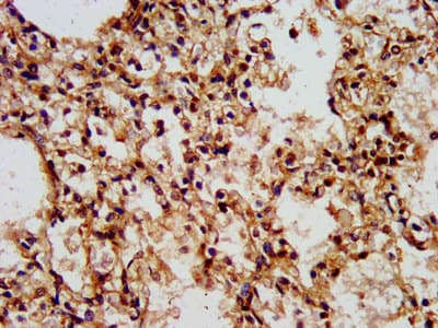 WASF2 / SCAR2 Antibody