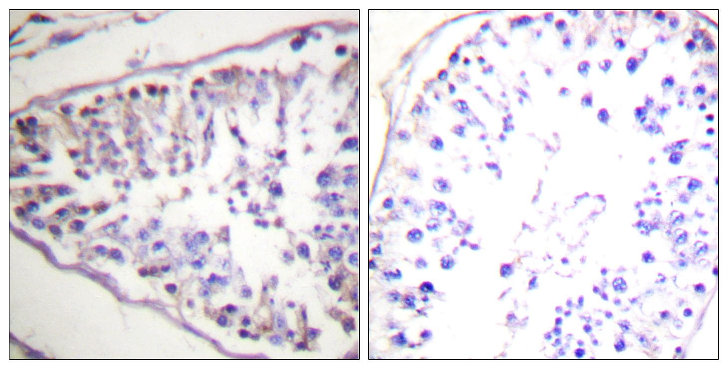 Polyclonal Rabbit anti-Human LIPE / HSL Antibody (p552, IHC, WB)