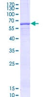 Human TRABD Protein (Recombinant GST)