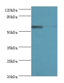 Polyclonal Rabbit anti-Human P4HA2 Antibody (aa236-535, IHC, WB)