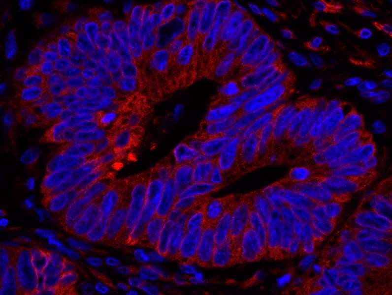 RCN1 / Reticulocalbin 1 Antibody (aa1-75)