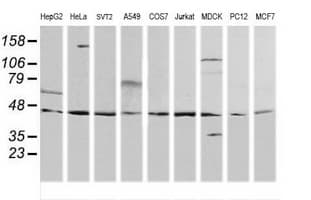 MAP2K2 / MKK2 / MEK2 Antibody (clone OTI5G8)