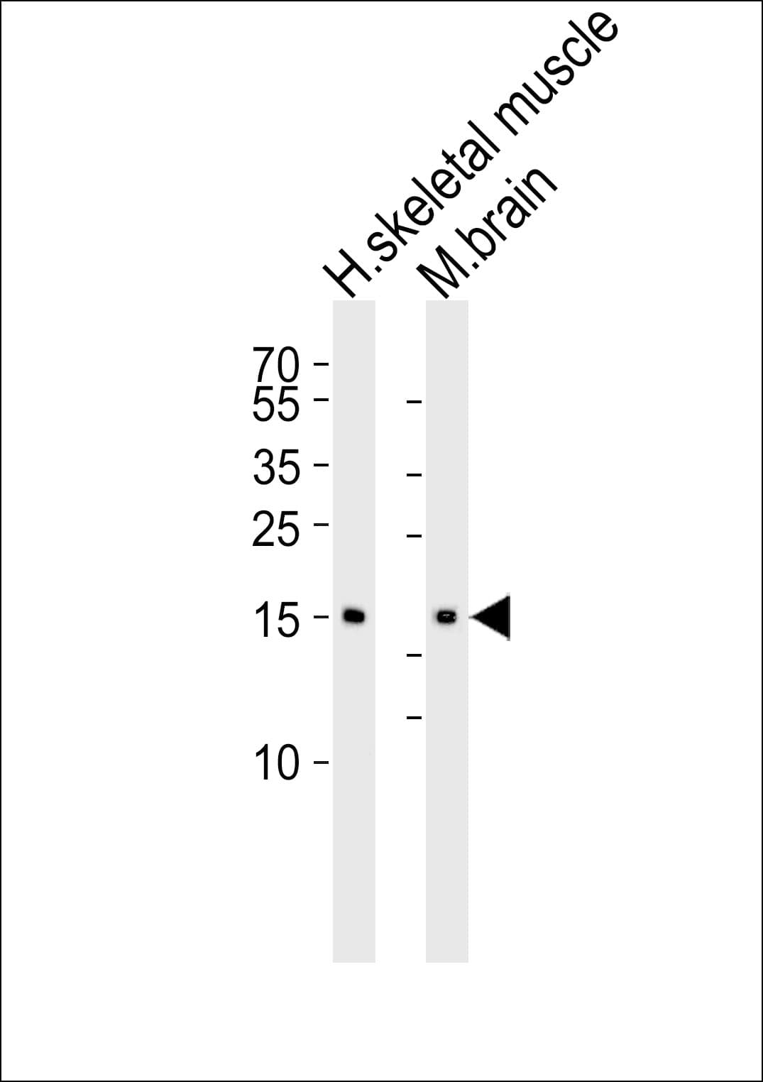 Polyclonal Rabbit anti-Human CFL2 / Cofilin 2 Antibody (aa130-144, IF, WB)