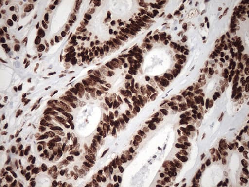 TRIM28 / KAP1 Antibody (clone OTI2H10)