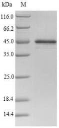Mouse Serpina3n Protein (Recombinant 6His, N-terminus)