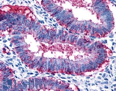 PathPlus™ Polyclonal Rabbit anti-Human RXFP2 / LGR8 Antibody (Cytoplasmic Domain, IHC, WB)