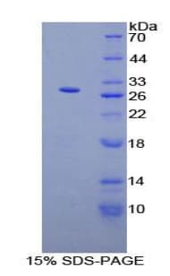 Human PTHLH / PTHRP Protein (Recombinant His-S)