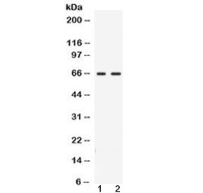 Polyclonal Rabbit anti-Human CCDC6 Antibody (WB)