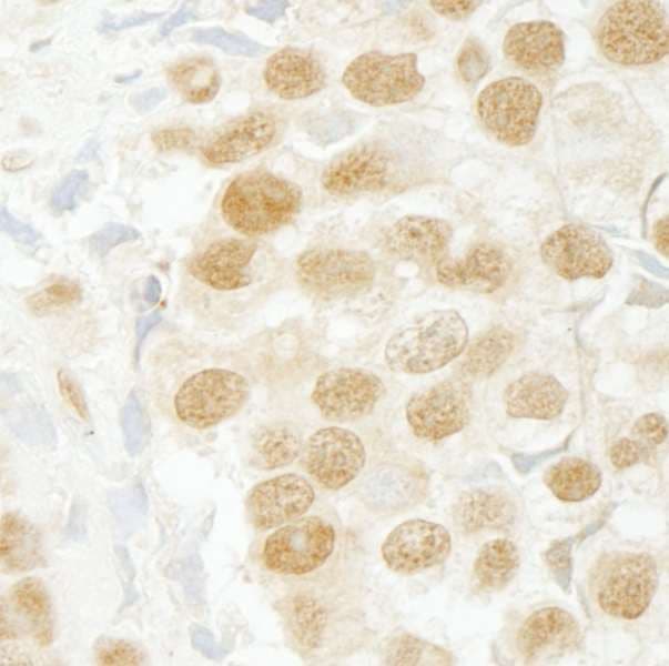 SCAF11 / SFRS2IP Antibody (aa1098-C-term)