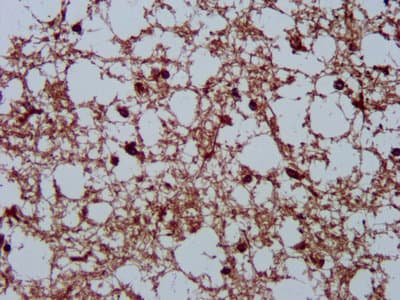 Polyclonal Rabbit anti-Human HSPA5 / GRP78 / BiP Antibody (IHC, WB)