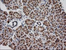 Monoclonal Mouse anti-Human MGLL / Monoacylglycerol Lipase Antibody (clone OTI1H1, IHC, IF, WB)