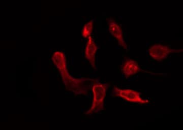 OR6P1 Antibody