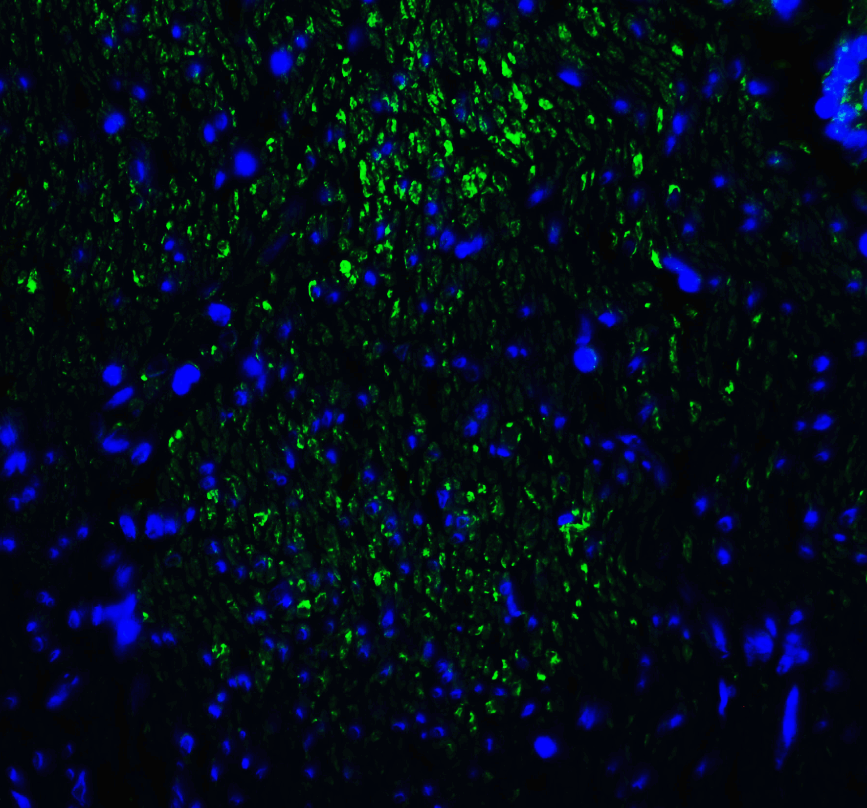 HAVCR2 / TIM-3 Antibody (clone 2A6)