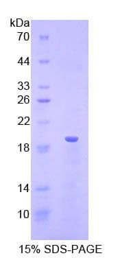 Human RNASE3 Protein (Recombinant His, N-terminus)