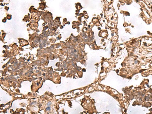Polyclonal Rabbit anti-Human FAAP24 Antibody (IHC)
