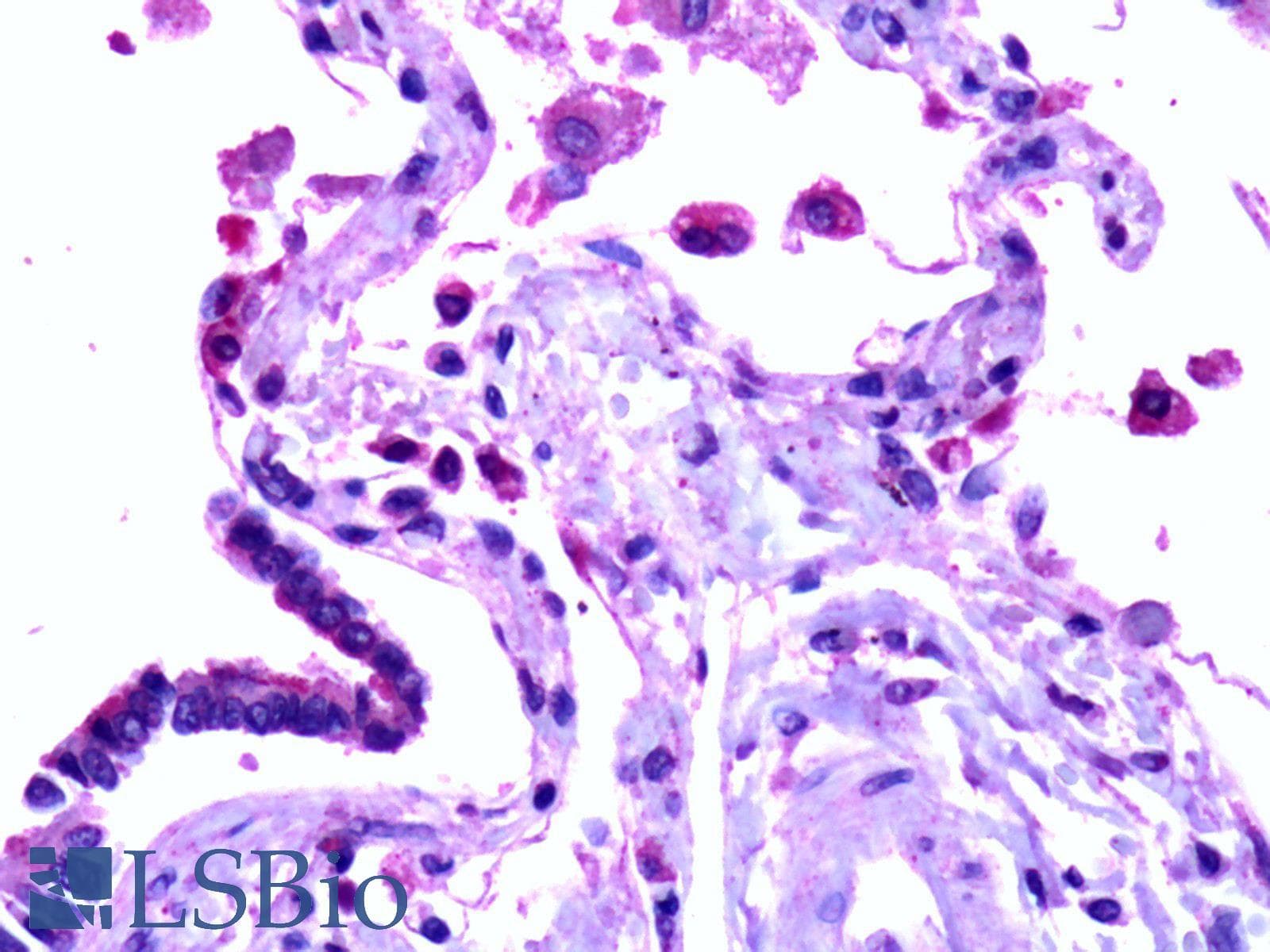 IHC-plus™ SFTPD / Surfactant Protein D Antibody (clone 2A10)