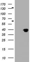 MAGEB1 Antibody (clone OTI6H6)