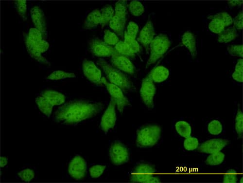 IHC-plus™ Monoclonal Mouse anti-Human GPN1 / XAB1 Antibody (clone 3E1, IHC, IF, WB)