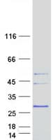 Human MARCH2 Protein (Recombinant Myc-DDK (Flag))